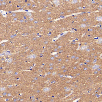 AP-2α Recombinant Rabbit mAb (S-4444-44)