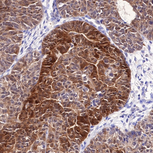 Stat5 Recombinant Rabbit mAb (S-R234)