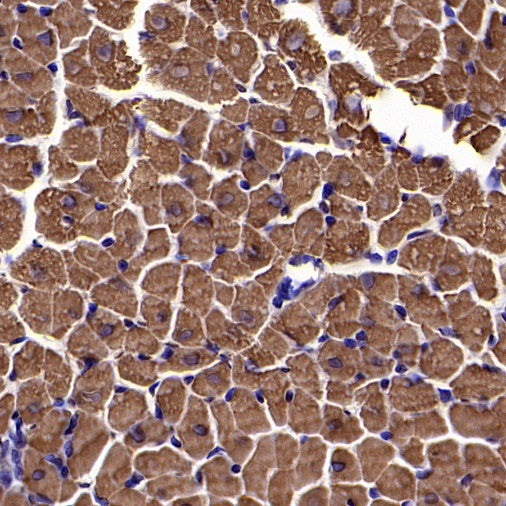 Cardiac troponin T (TNNT2) Recombinant Rabbit mAb (SDT-2894-34)