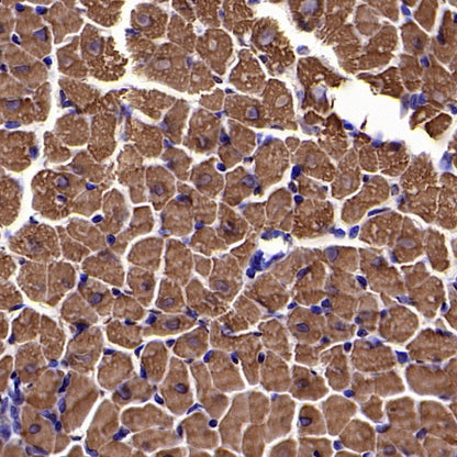 Cardiac troponin T (TNNT2) Recombinant Rabbit mAb (SDT-2894-34)