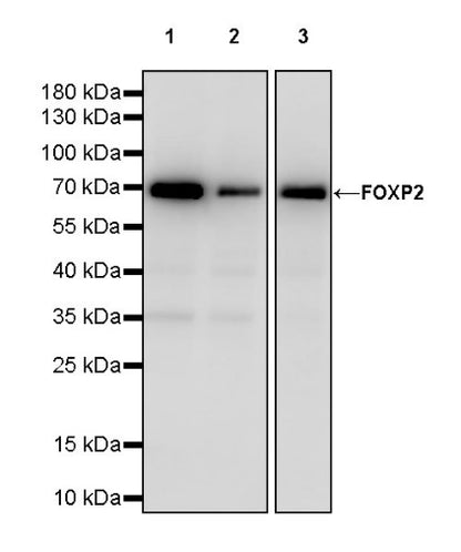 FOXP2 Recombinant Rabbit mAb (S-2342-8)