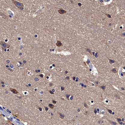 Park7/DJ-1 Recombinant Rabbit mAb (S-980-144)