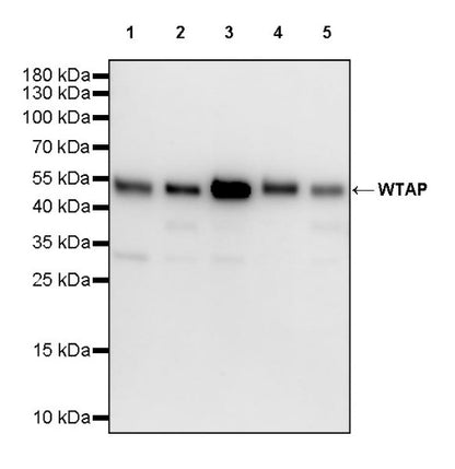 WTAP Recombinant Rabbit mAb (S-2741-49)