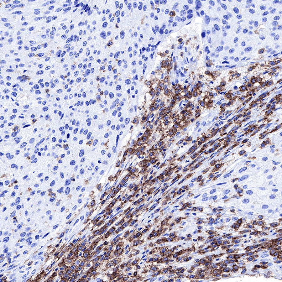 S-RMab® CD45 Recombinant Rabbit mAb,PBS Only (SDT-R035)