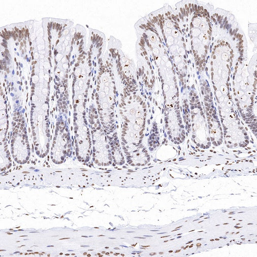 Histone H3 (mono methyl K79) Recombinant Rabbit mAb (S-R417)