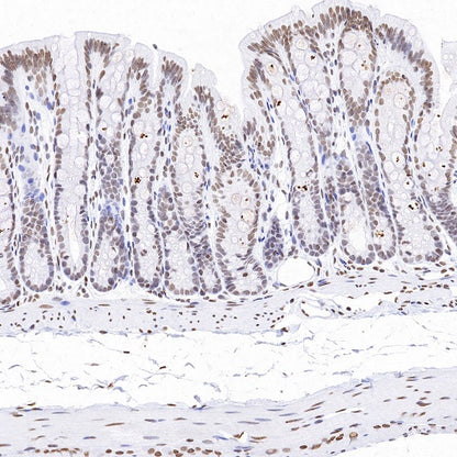 Histone H3 (mono methyl K79) Recombinant Rabbit mAb (S-R417)