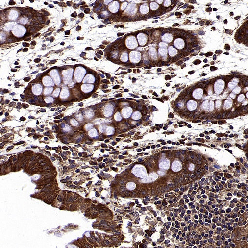 GSPT1 Recombinant Rabbit mAb (S-1914-49)