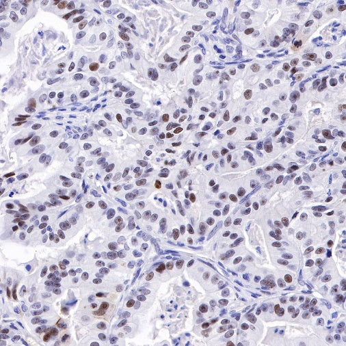 Nucleophosmin/NPM Recombinant Rabbit mAb (S-R231)