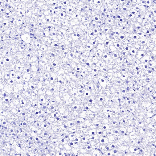 BACE1 Recombinant Rabbit mAb (S-2514-34)