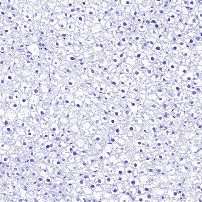 BACE1 Recombinant Rabbit mAb (S-2514-34)