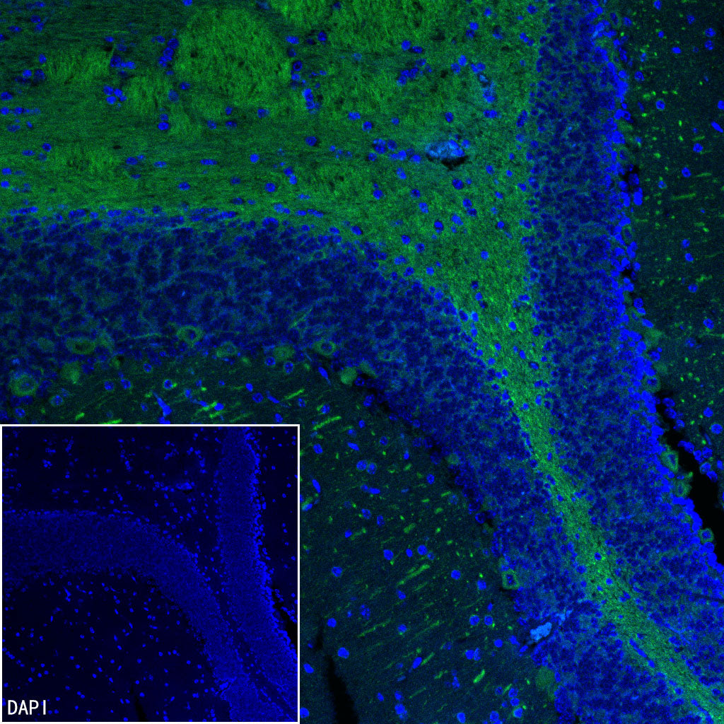 Beta III tubulin Recombinant Rabbit mAb (Alexa Fluor® 488 Conjugate) (SDT-251-28)
