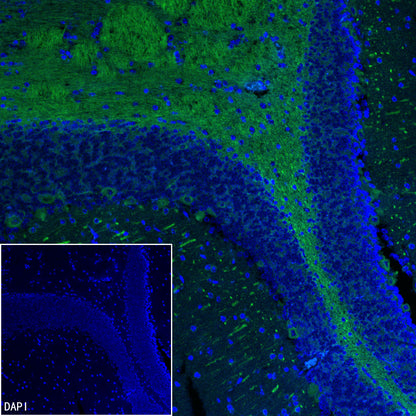 Beta III tubulin Recombinant Rabbit mAb (Alexa Fluor® 488 Conjugate) (SDT-251-28)