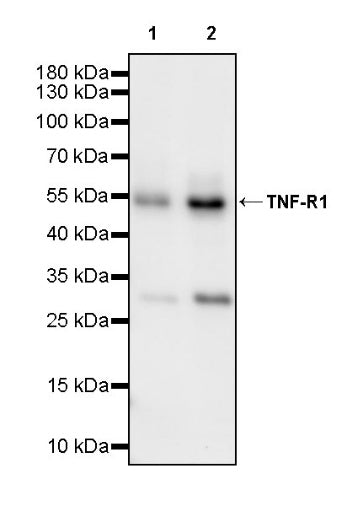 TNF-R1 Recombinant Rabbit mAb (S-4713)