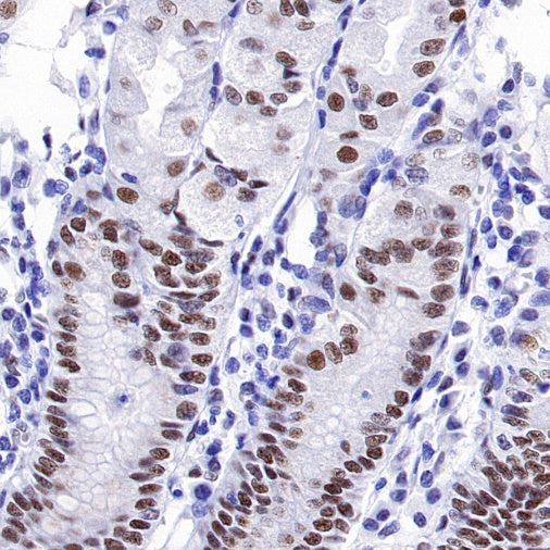 KDM1/LSD1 Recombinant Rabbit mAb (S-1280-80)