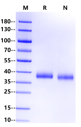 IL-2 R beta/CD122 His Tag Protein, Human