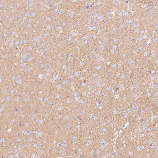 PSEN1 Recombinant Rabbit mAb (S-1002-129)