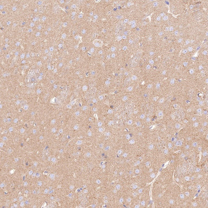 PSEN1 Recombinant Rabbit mAb (S-1002-129)