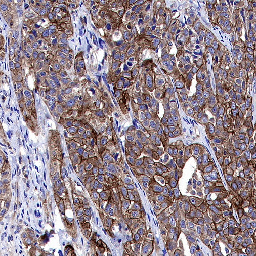 Atg5 Recombinant Rabbit mAb (S-3181)