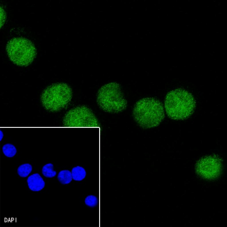 S-RMab® PAX5 Recombinant Rabbit mAb (SDT-R202)