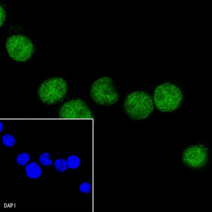 S-RMab® PAX5 Recombinant Rabbit mAb (SDT-R202)