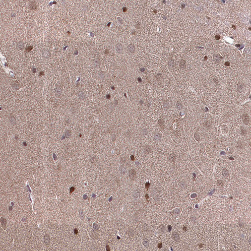 ADK Rabbit Polyclonal Antibody