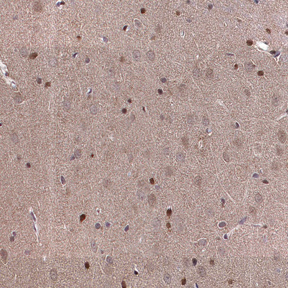 ADK Rabbit Polyclonal Antibody