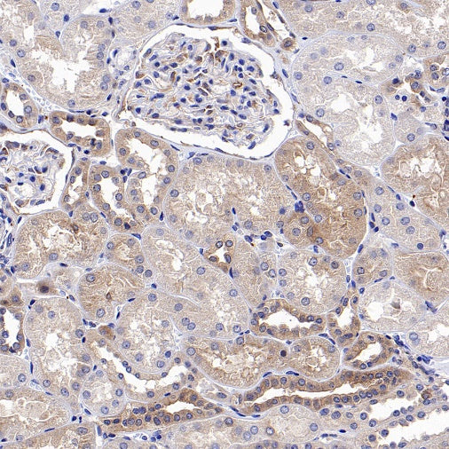 Src Recombinant Rabbit mAb (S-1181-16)