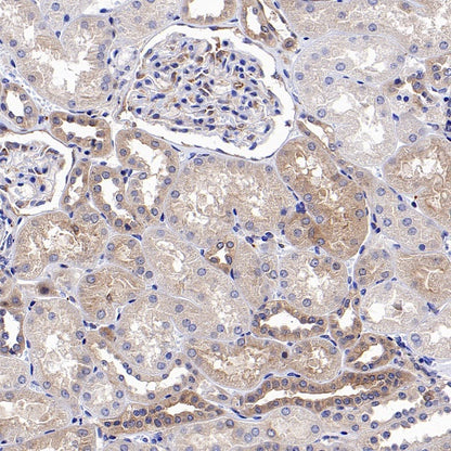 Src Recombinant Rabbit mAb (S-1181-16)