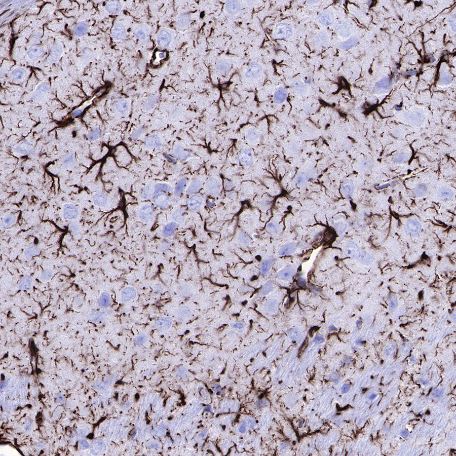 GFAP Recombinant Rabbit mAb (SDT-306-10)