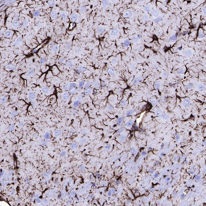 GFAP Recombinant Rabbit mAb (SDT-306-10)