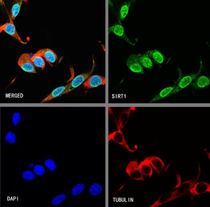 SIRT1 Recombinant Rabbit mAb (S-1886-15)