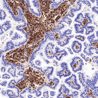 VISTA Recombinant Rabbit mAb (S-1013-5)