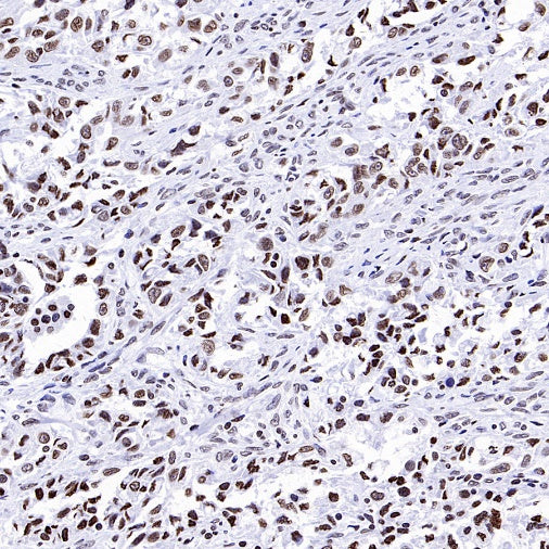 Histone H3 (mono methyl K36) Recombinant Rabbit mAb (S-859-505)
