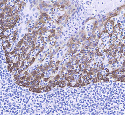 Keratin 14 Recombinant Rabbit mAb(SDT-023-1)