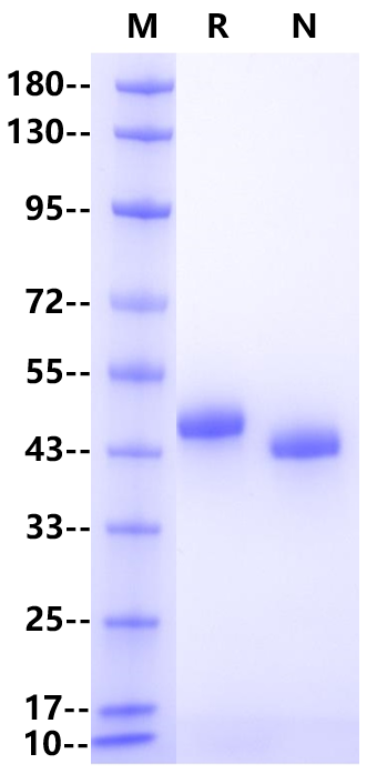 Nectin-4 His Tag Protein, Human