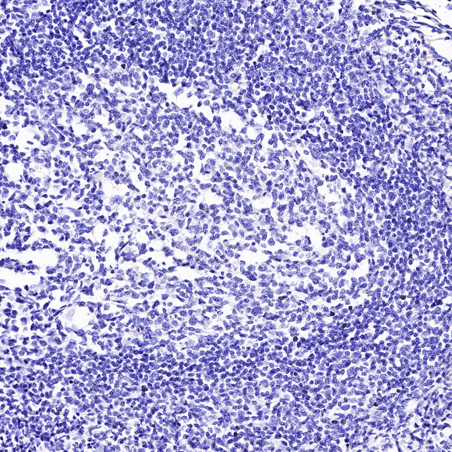 ACTH Recombinant Rabbit mAb (SDT-363-60)