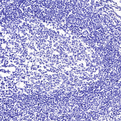 ACTH Recombinant Rabbit mAb (SDT-363-60)