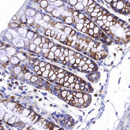 NDRG1 Recombinant Rabbit mAb (S-623-82)
