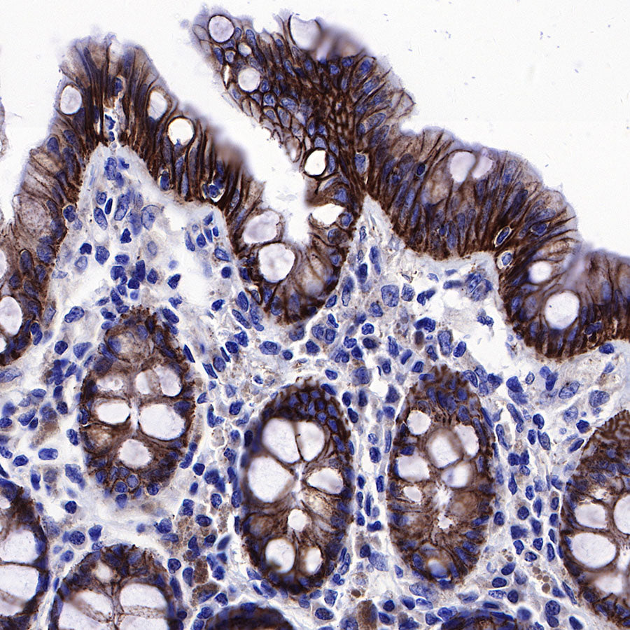β-Catenin Recombinant Rabbit mAb,PBS Only (SDT-336-23)