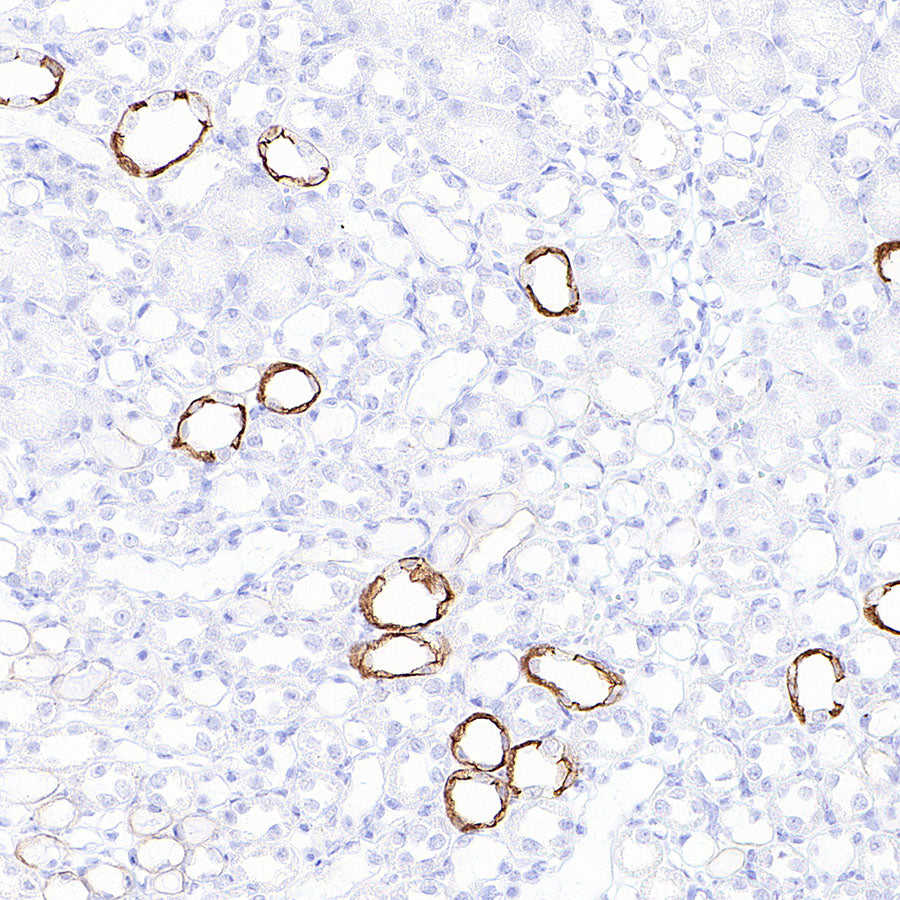Cytokeratin 7 Recombinant Rabbit mAb (S-5954)