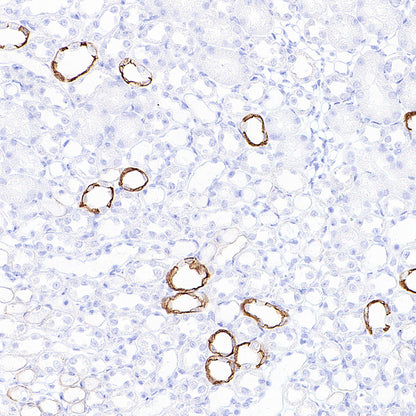 Cytokeratin 7 Recombinant Rabbit mAb (S-5954)