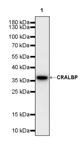 CRALBP Rabbit Polyclonal Antibody