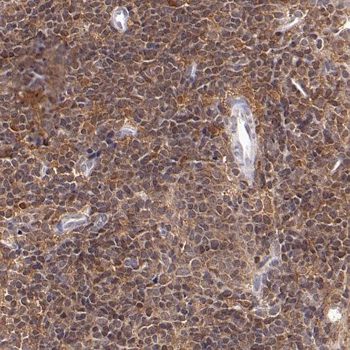 ASC/TMS1 Rabbit Polyclonal Antibody