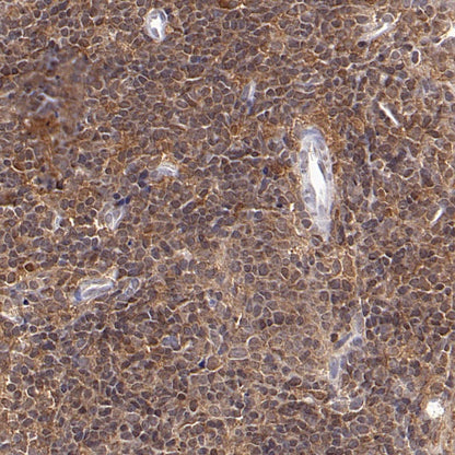 ASC/TMS1 Rabbit Polyclonal Antibody