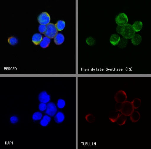 Thymidylate Synthase Recombinant Rabbit mAb (S-753-7)