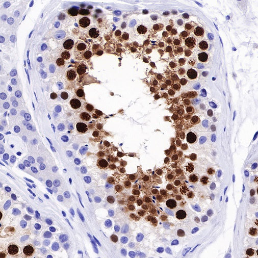 Topoisomerase II alpha Recombinant Rabbit mAb (S-513-7)