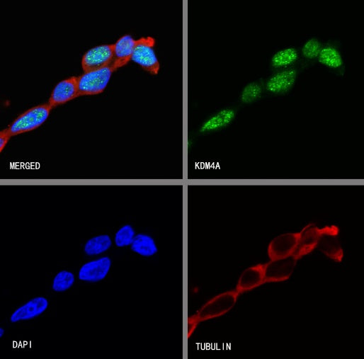 KDM4A Recombinant Rabbit mAb (S-957-138)