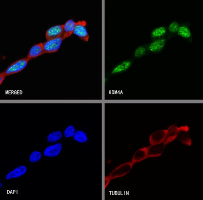 KDM4A Recombinant Rabbit mAb (S-957-138)