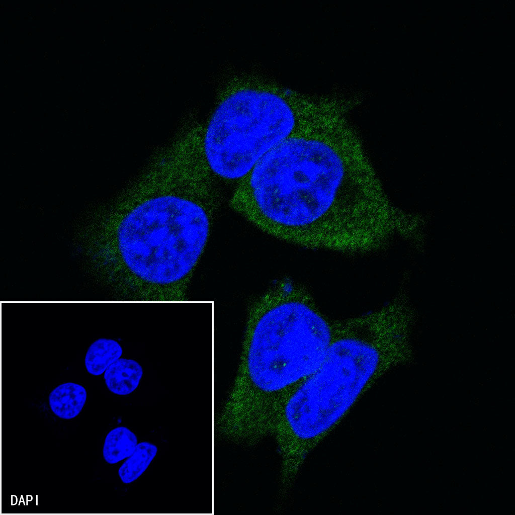 TBK1/NAK Recombinant Rabbit mAb (S-658-50)