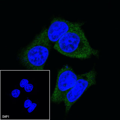 TBK1/NAK Recombinant Rabbit mAb (S-658-50)